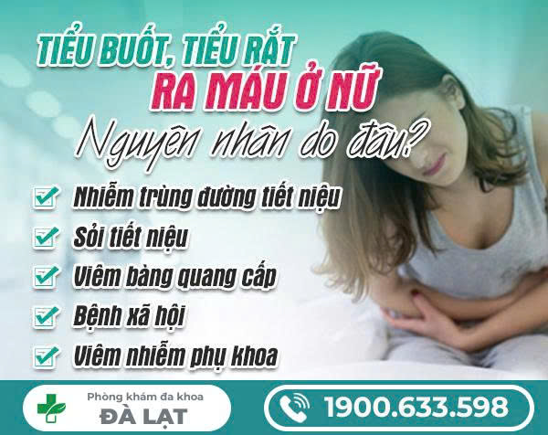 Hình ảnh minh họa